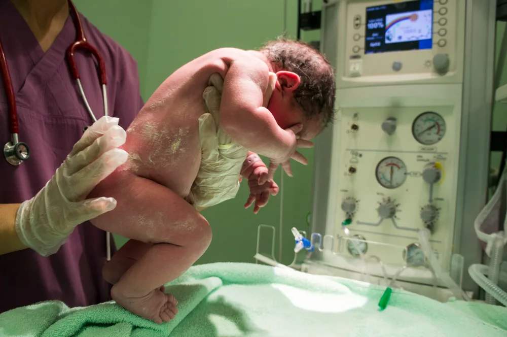 Atención del parto y reanimación neonatal en CDMX: Cuidado desde el nacimiento